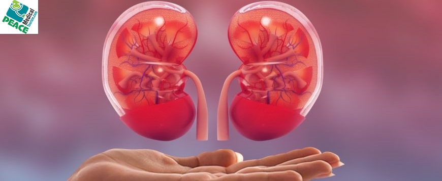 Kidney Transplant Cost in Delhi