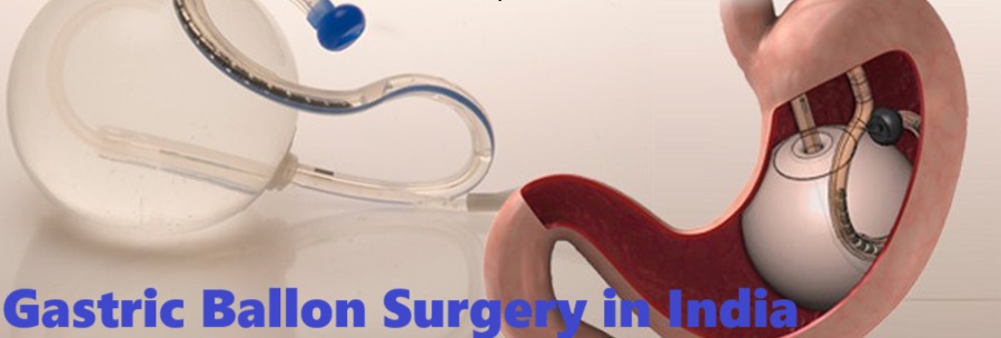 Gastric Balloon Surgery in India