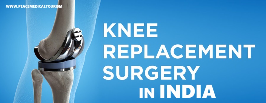 Knee Replacement Surgery in India