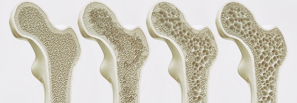 Bone healthy Tips that keep your bones strong