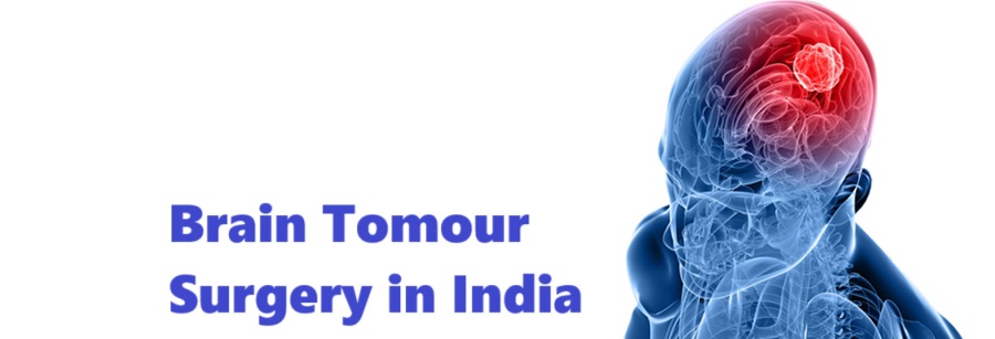 Brain Tumor Surgery in India